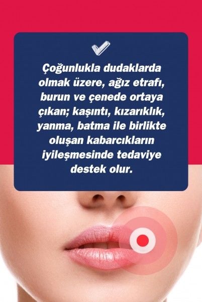 TTO UX Dudak Kremi 10 ml
