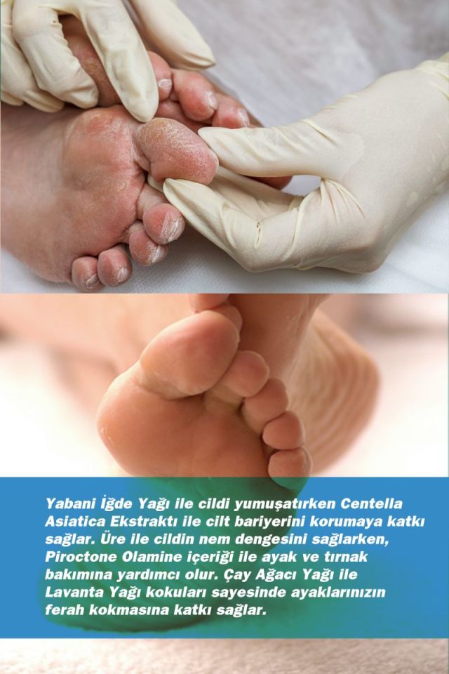 TTO Clinic Ayak Bakım Köpüğü 150 ml