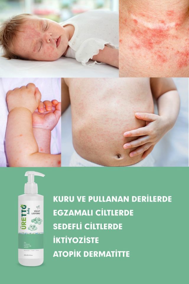 TTO Üretto Baby Vücut Losyonu 200 ml