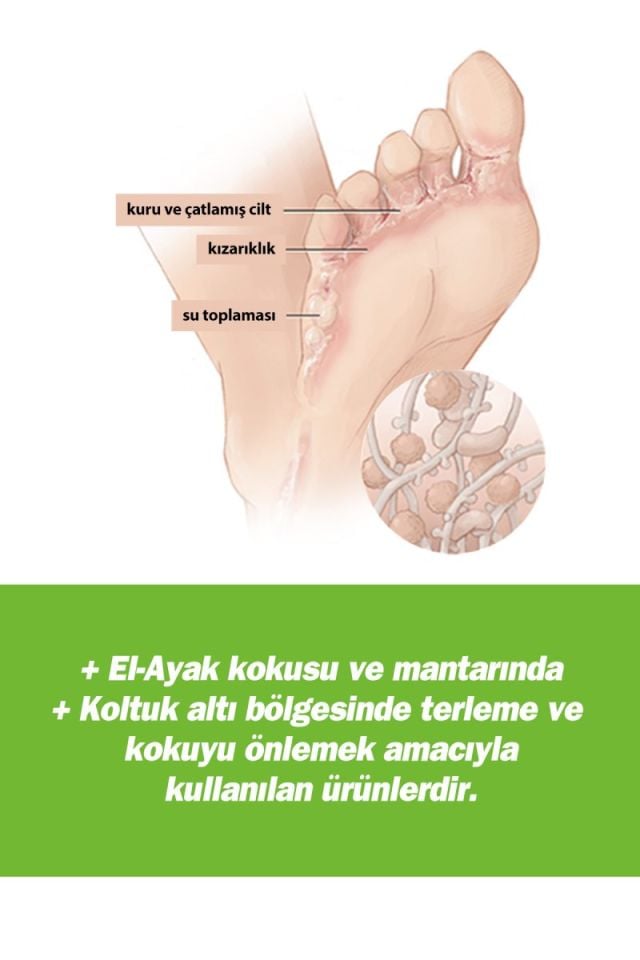 TTO Terleme Karşıtı Set (Sprey, Roll-on, Mendil, Şampuan)